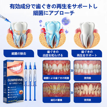 CleraNaure® GumRevive fogágy-szövetregeneráló gél