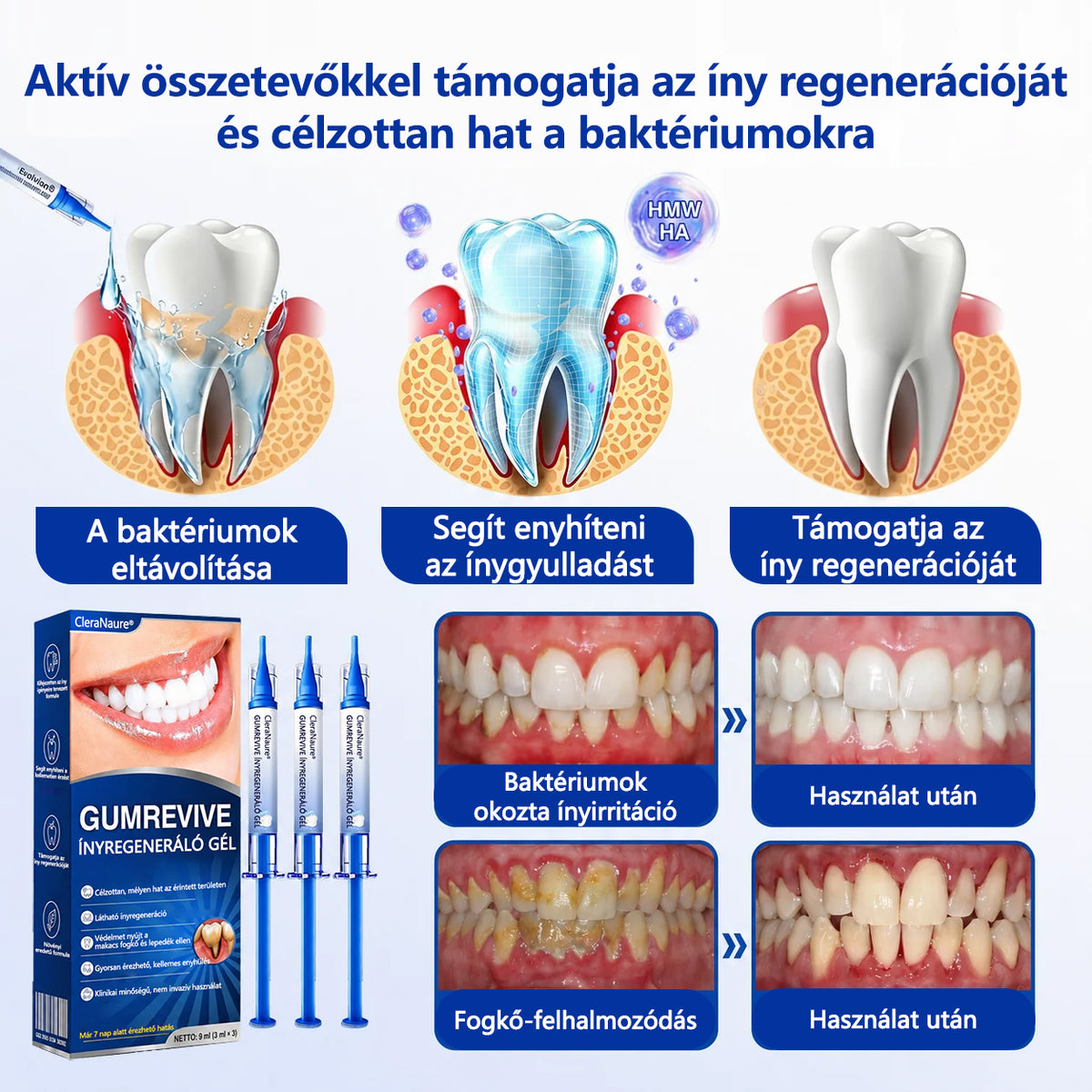 CleraNaure® GumRevive fogágy-szövetregeneráló gél