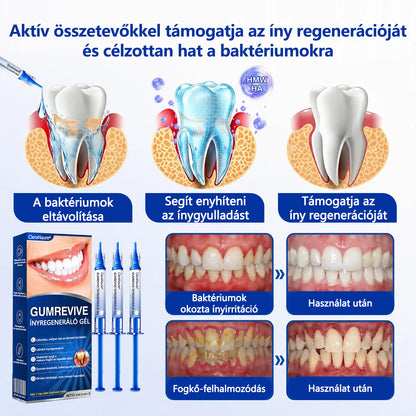 CleraNaure® GumRevive fogágy-szövetregeneráló gél