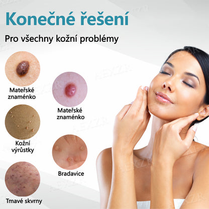 💥💥Foulme® PRO Neinvazivní laserové pero na odstraňování bradavic a znamének💥💥