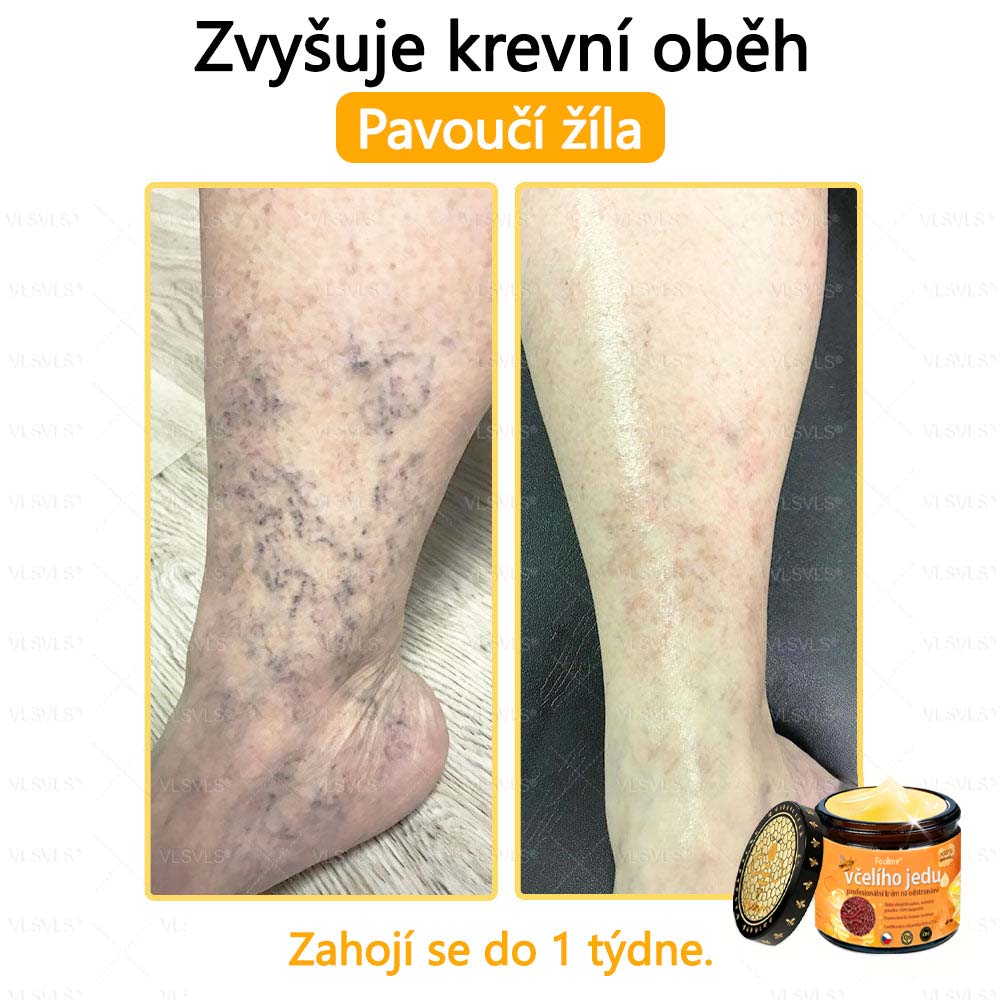 ✅Foulme® Obnovující krém se včelím jedem🐝