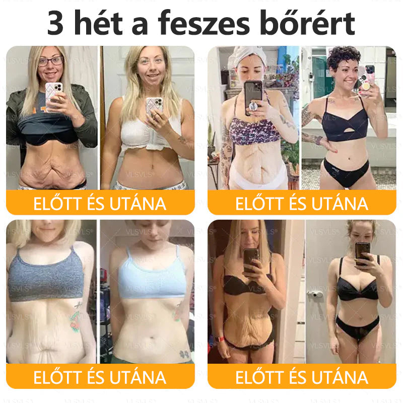 CleraNaure® Méhméreg Bőrregeneráló Krém