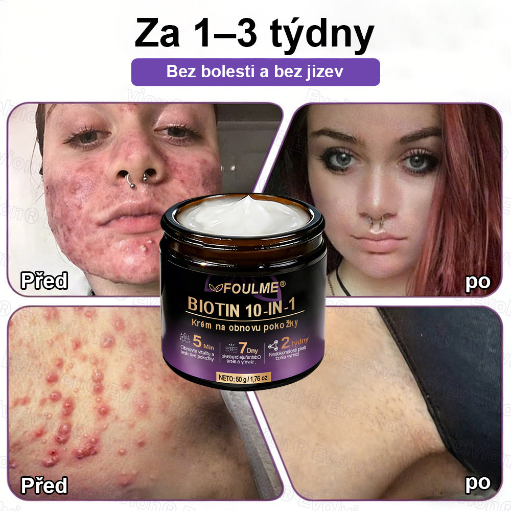 ✅Vyrobeno a dodáno z České republiky ✨⚡ FOULME® Biotin 10-v-1 krém na obnovu pokožky