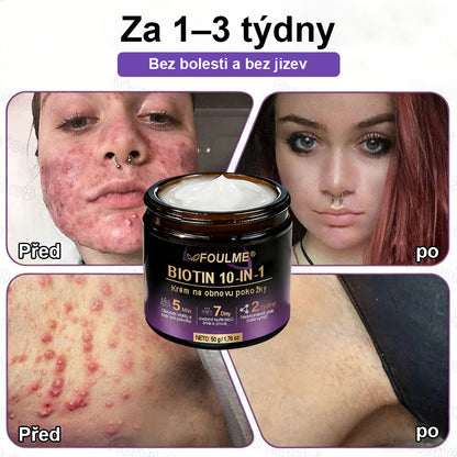 ✅Vyrobeno a dodáno z České republiky ✨⚡ FOULME® Biotin 10-v-1 krém na obnovu pokožky